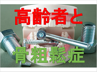 高齢者と骨粗しょう症