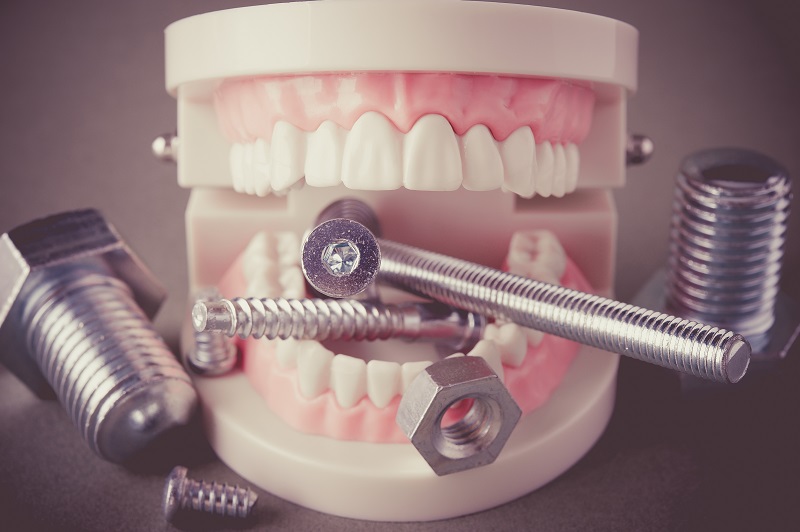 歯のイメージ写真